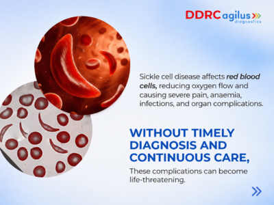 DDRC Agilus Diagnostics